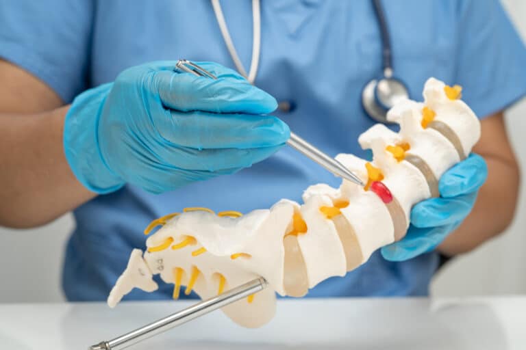 Physician using medical model to explain spine surgeries