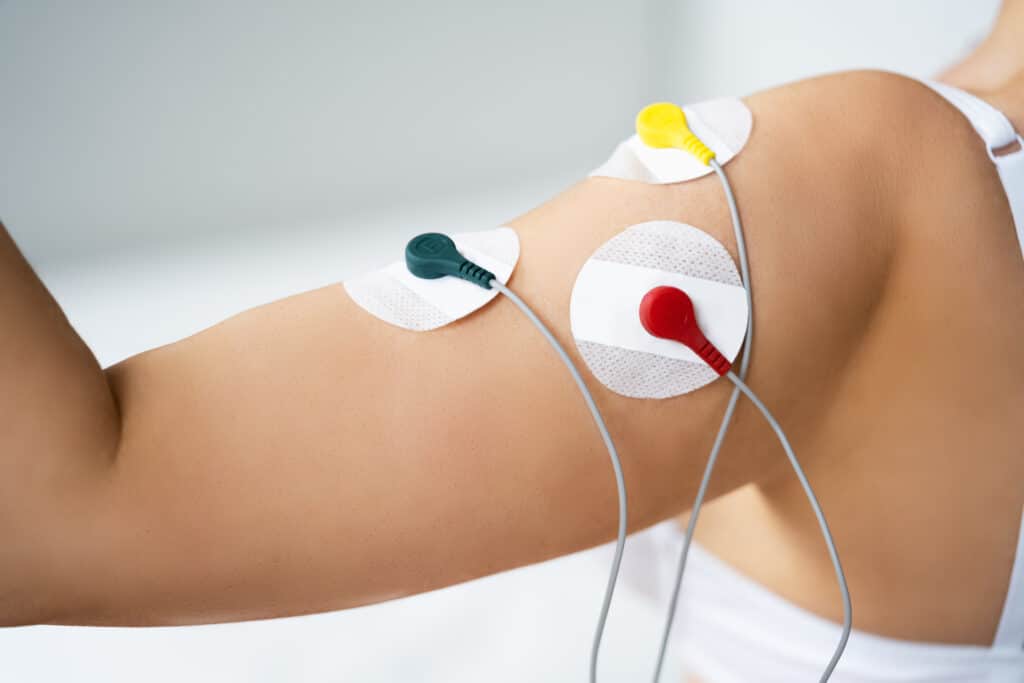 Close image of electrodes placed on patient’s arm