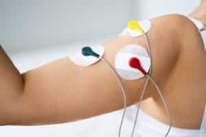 Close image of electrodes placed on patient’s arm