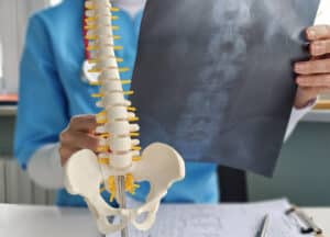 Doctor holding up model of spine and patient X-ray scan