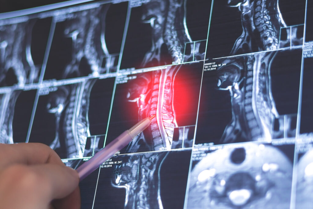 Doctor examining medical imaging of spine